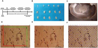 Transcutaneous Auricular Vagus Nerve Stimulation Promotes White Matter Repair and Improves Dysphagia Symptoms in Cerebral Ischemia Model Rats